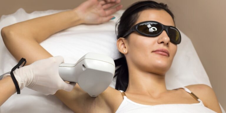 Laser Hair Removal